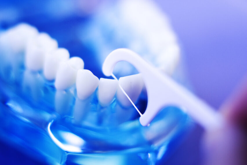 Tanntr&aring;d er et viktig virkemiddle for &aring; forebygge mot gingivitt