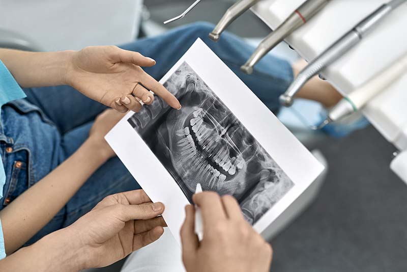 Tannlegeundersøkelser | Oslo Tannlegesenter